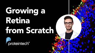Grow a Retina From Scratch