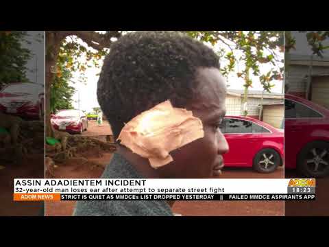 32-year-old man loses ear after attempt to separate street fight – Adom TV News (21-9-21) 32-year-old man loses ear after attempt to separate street fight – Adom TV News (21-9-21)