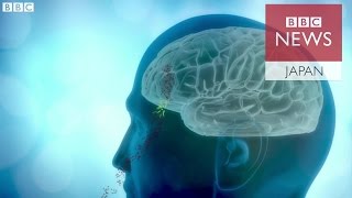 大気汚染物質が脳に　認知症に関係か