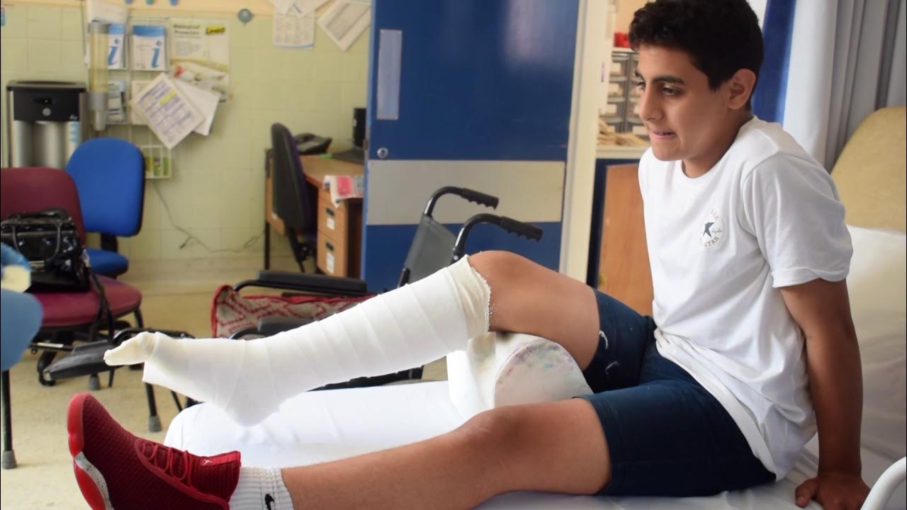 My broken i leg have