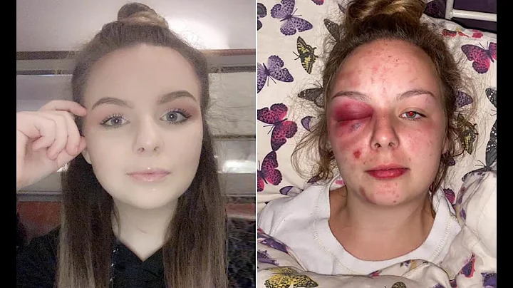 (UPDATED) Woman attacks herself with Hammer and cl...