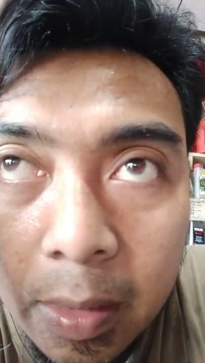 belatung viral