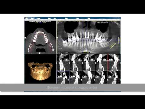 Vídeo: Com es diagnostica el deteriorament ortopèdic?