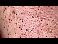 Dr skincare acne blackheadswhiteheads treatments pimple part 8 full screen