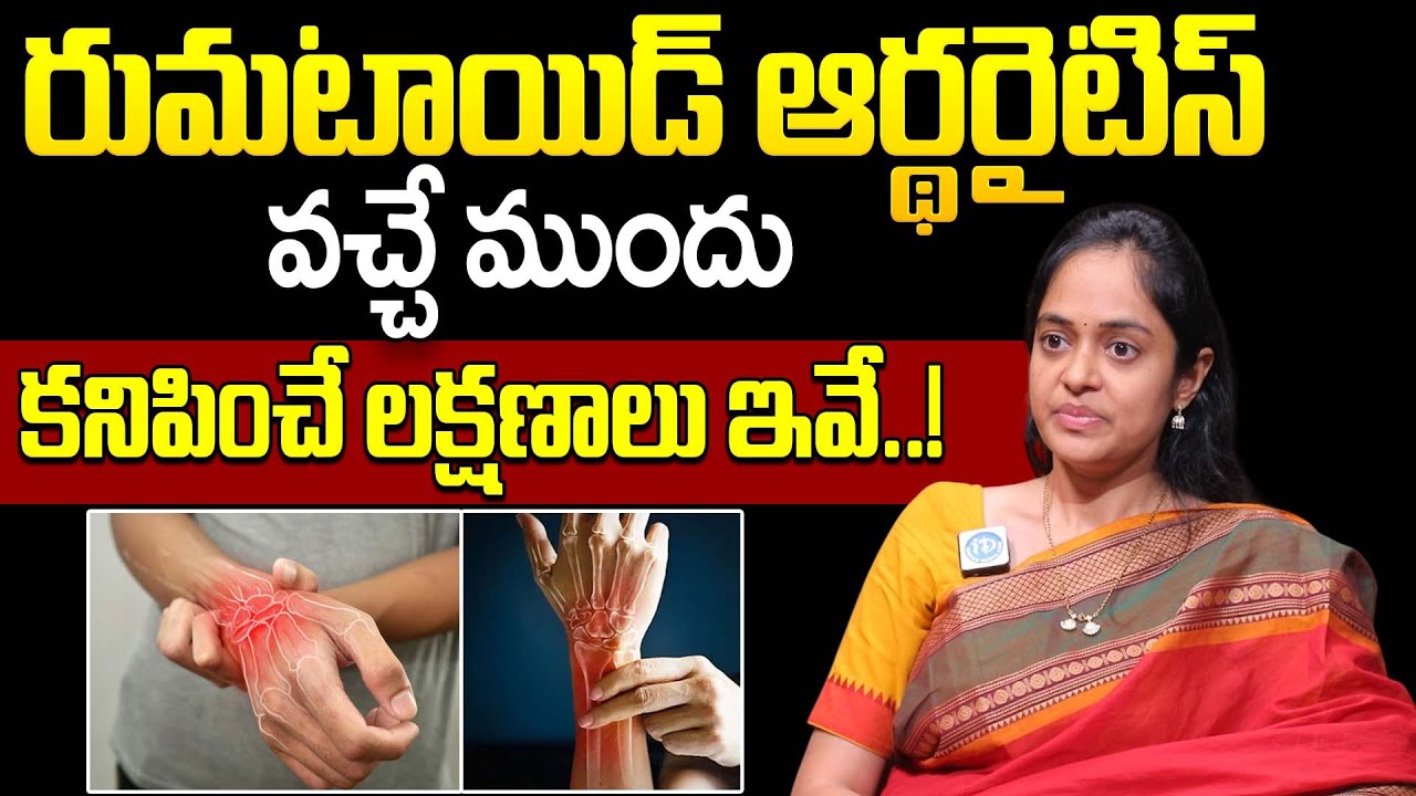 రుమటాయిడ్ ఆర్థరైటిస్ వచ్చే ముందు కనిపించే లక్షణాలు ఇవే..! || Rheumatoid Arthritis Symptoms in Telugu