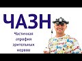 ЧАЗН- Частичная атрофия зрительных нервов