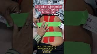 Slip Disc, Disc Bulge Kinesio-Taping Technique
