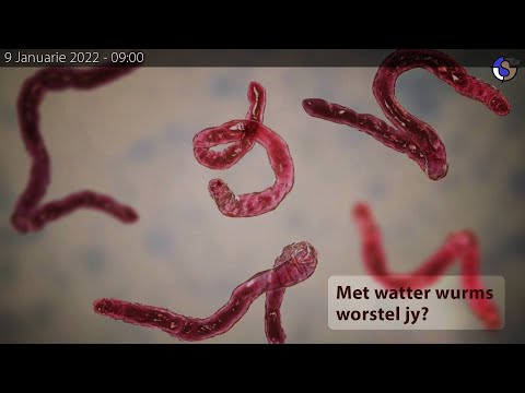 Video: Watter spesiale bestuurstegnieke kan jy gebruik vir nagbestuur?