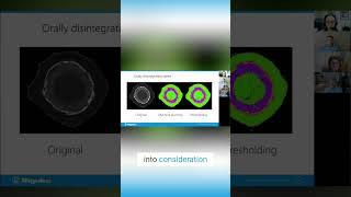 Deep Learning Segmentation  The Ultimate CT Data Analysis