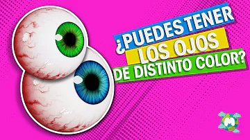 ¿Es raro tener dos ojos de distinto color?