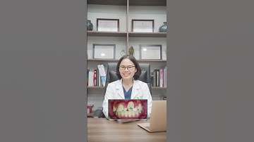 Nhổ răng thừa có cần niềng răng không? #shorts #niengrang