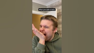 Thumbnail of When Your Palm Is Itchy #Shorts