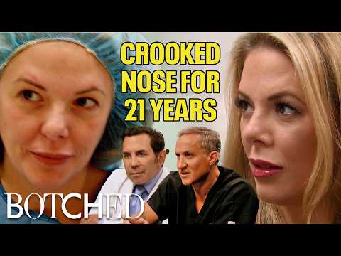 Dana's MUTILATED Nose Has Bone Spurs and An Insanely Deviated Septum (Before & After) | Botched | E!