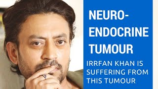 Everything about Neuroendocrine Tumour.:A rare disease Irrfan Khan is suffering from.