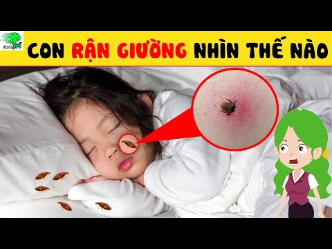 Video: Tại sao bạn nên quan tâm đến Ký sinh trùng?