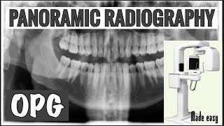 PANORAMIC RADIOGRAPHY II OPG II EXTRAORAL RADIOGRAPHY II ORAL RADIOLOGY screenshot 5