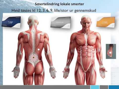 Video: Ulcerøs Colitis Smertelindring: Hvordan Man Håndterer UC-smerte