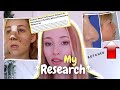 Rhinoplasty Revision Statistics &amp; My Rhinoplasty Complication / Nose Job Recovery