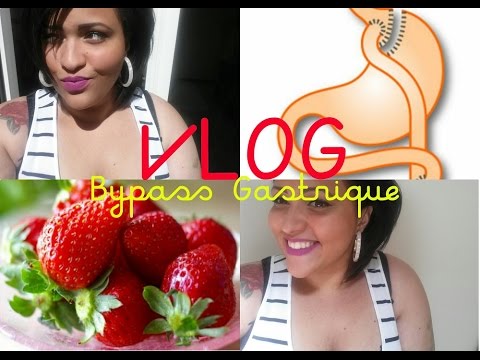 VLOG : Bypass J+22 - YouTube VLOG : Bypass J+22 - YouTube