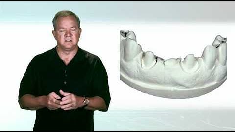 Development and Communication of Ovate Pontic Site