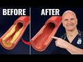 2 Foods UNCLOG Arteries Fast! (Proven by Science)