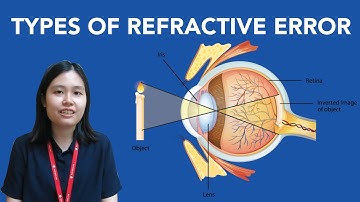 #CFSSHARE : Types of Refractive Errors