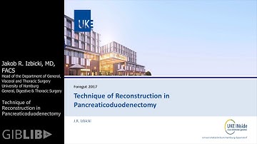 Pancreatic Cancer: Technique of Reconstruction in Pancreaticoduodenectomy | Preview