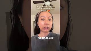 Career Overview THIS is normal // Acne Awareness Month Real Skin Challenge
