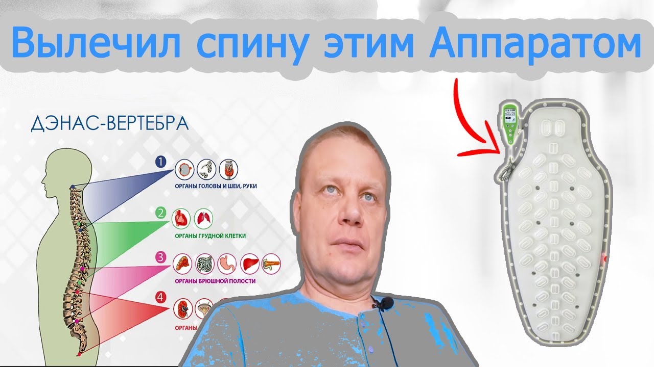 Аппарат Дэнас Вертебра - решение для лечения больной спины