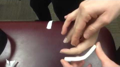 PIP dorsal blocking splint