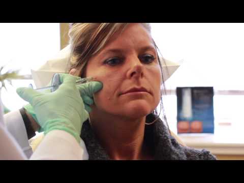 Juvederm Voluma XC Demonstration