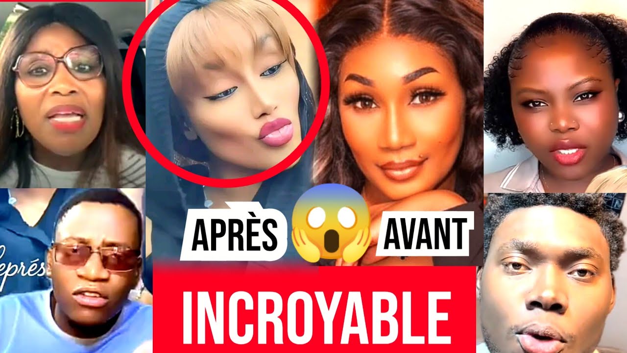 🚨 LE NOUVEAU VISAGE DE EMMA LOUHOUES FAIT PEUR AUX INTERNAUTES SORTEZ OH : LES REACTlØNS