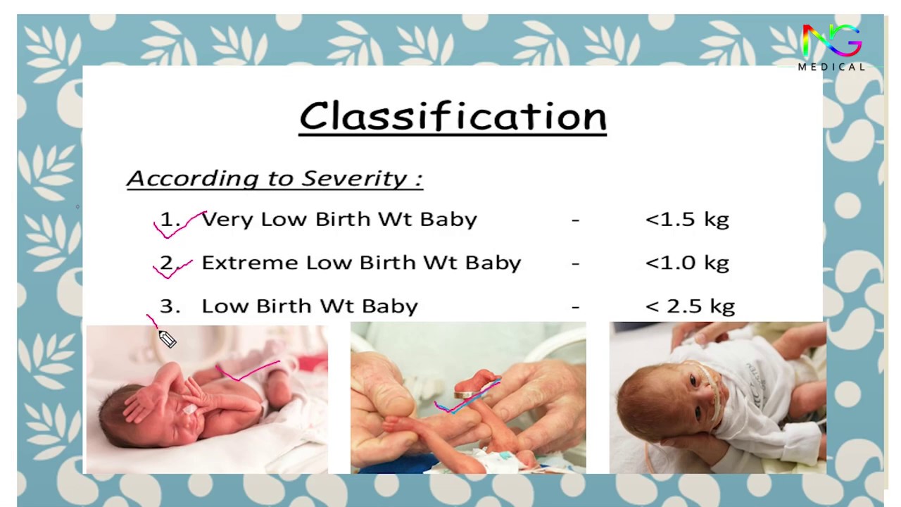 Low Birth Weight Baby EASY NOTES Full Explanation In Hindi By N G 