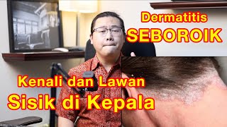 Seborrheic dermatitis. Stubborn scales on the scalp. Here's how to prevent and treat it.