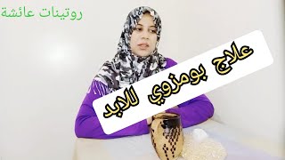 علاج بومزوي(القولون العصبي) بطريقة سهلة وناجحة