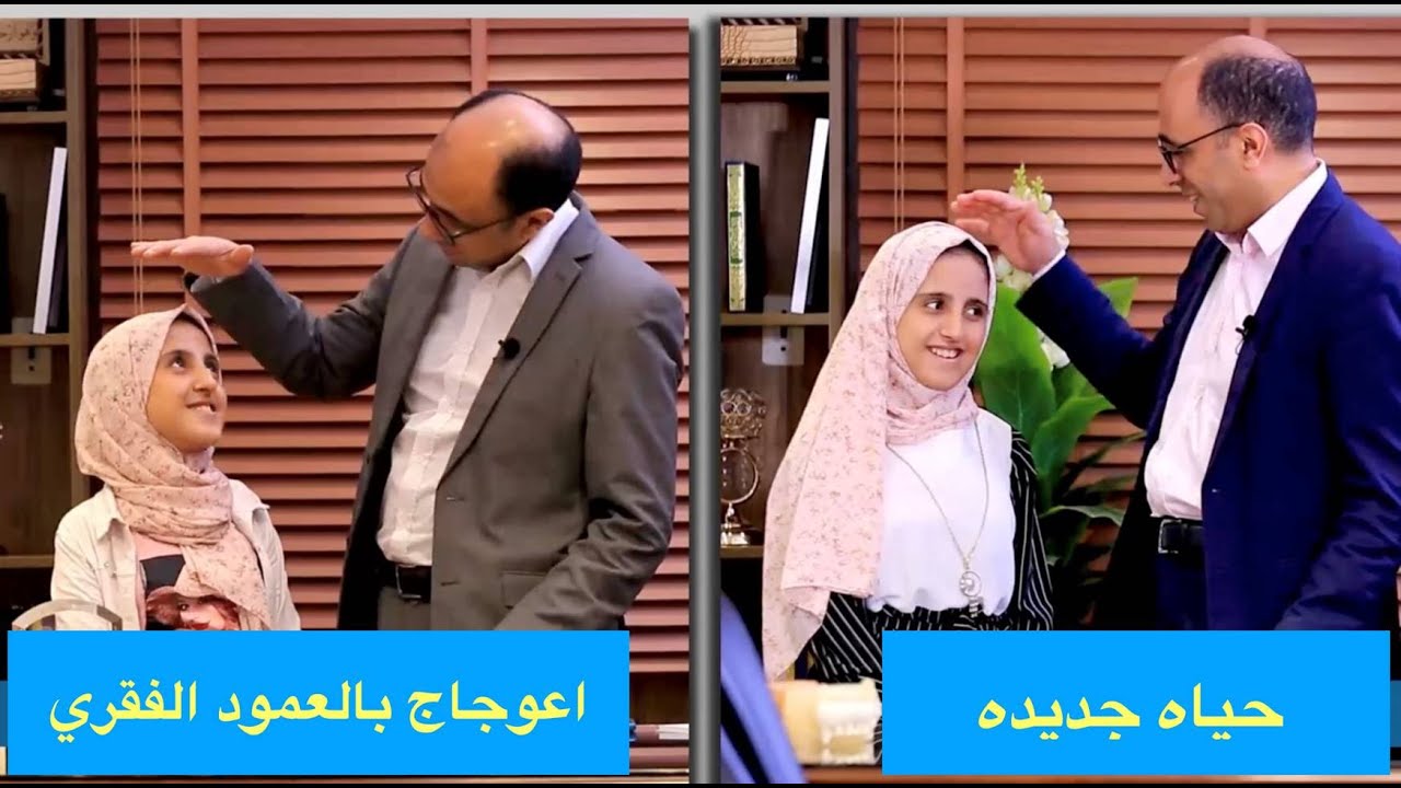 نجاح جراحه خطيره لتصليح اعوجاج بالعمود الفقري. مقارنه قبل و بعد الجراحه توضح تغير رهيب في حياة وئام