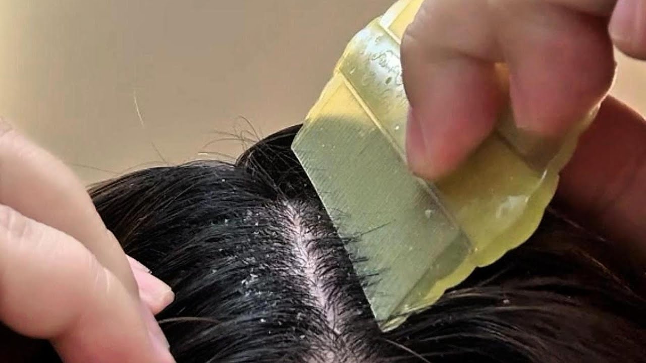 💤 Ultimate Self Scalp Scratching & Cleaning ASMR | ZZ Model | Sleep, Relaxation & Anxiety Relief