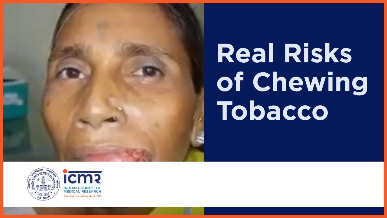 Smokeless Tobacco Campaign, The Story of Mukesh