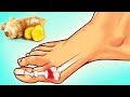 30 FEET AND SHOE HACKS THAT WILL EASE YOUR LIFE