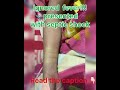 Ignored fever developed septic shock/untreated fever developed septic shock