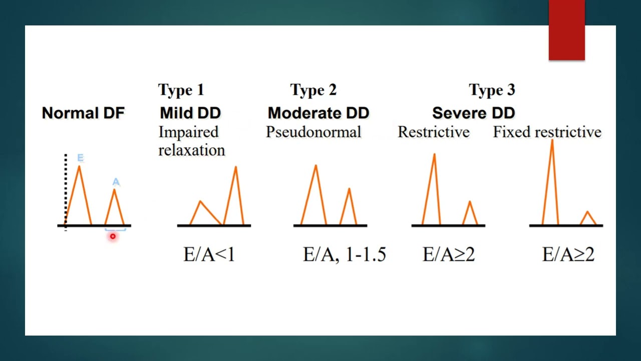 Diastology in echocardiography: CCM