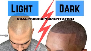 Dark Vs Light Scalp MicroPigmentation 〈 Achieving a Natural Look 〉