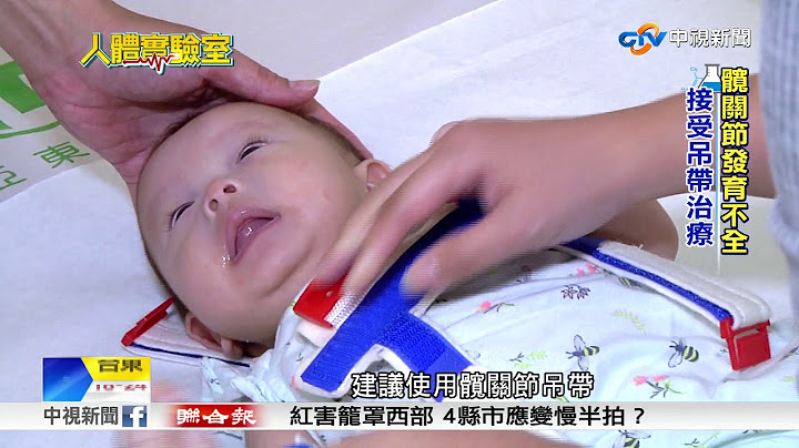 人體實驗室~新生兒髖關節脫臼 恐導致日後長短腳│中視新聞 20180105 - 天天要聞