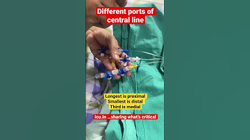 #icushort 11: Different ports in central line in icu