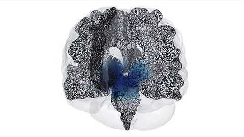 A time-lapse look at how Alzheimer’s spreads