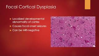 Seizures and Epilepsy - ULTIMATE NEUROLOGY USMLE STEP 1/2CK REVIEW