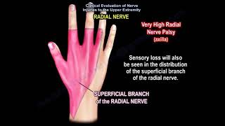 radial nerve injury, wrist drop, anatomy of the radial nerve.