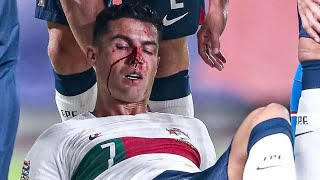 Cristiano Ronaldo nose injury | Bleeding | against Czech Republic