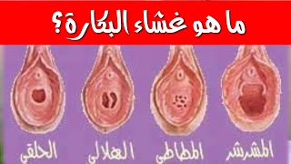 ما هو غشاء البكارة؟ ما هي انواع غشاء البكارة؟