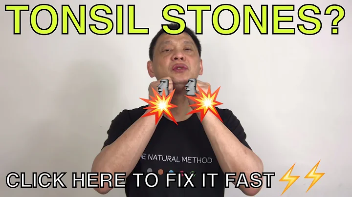 How to naturally get rid of tonsil stones